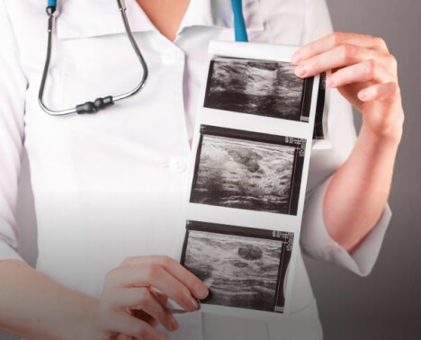 Image of a doctor holding breast ultrasound scan report