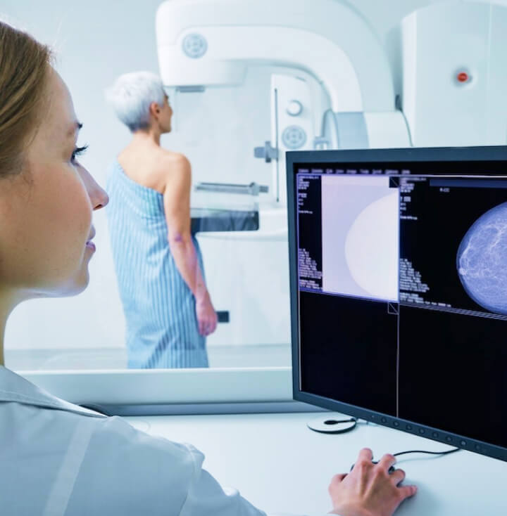 A lab technician taking a mammograph of an older woman