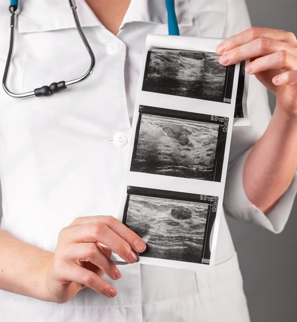 A lady doctor showing scan report